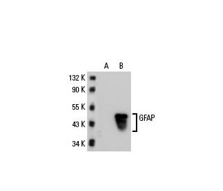GFAP Antibody (1.BB.807) - Western Blotting - Image 20168 