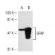 GFAP Antibody (1.BB.807) - Western Blotting - Image 40575 