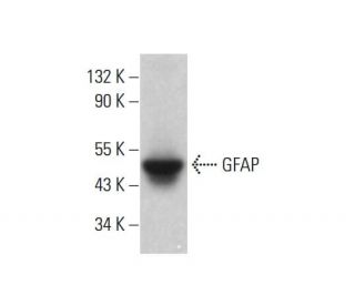 GFAP Antibody (2A5) - Western Blotting - Image 382587 