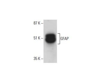 GFAP Antibody (F-2) - Western Blotting - Image 395740 