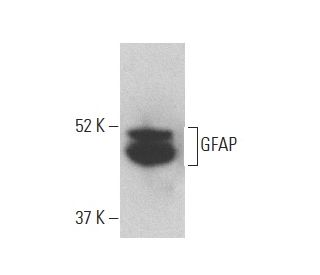 GFAP Antibody (F-7) - Western Blotting - Image 400031 