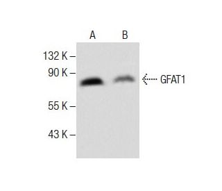 GFAT1 Antibody (D-9) - Western Blotting - Image 285022The Double Nickase Plasmid features a U6 promoter for sgRNA expression, a 20 nt targeting sequence, and a gRNA scaffold to guide Cas9n. It includes a CBh promoter for Cas9n (D10A) and puromycin resistance, GFP for transfection verification, and nuclear localization signals (NLS). The 2A peptide allows co-expression of Cas9n and Puro from a single promoter, enabling precise genome editing with reduced off-target effects.