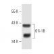 Gfi-1B Antibody (B-7) - Western Blotting - Image 8820 