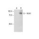 GGA1 Antibody (D-8) - Western Blotting - Image 288263