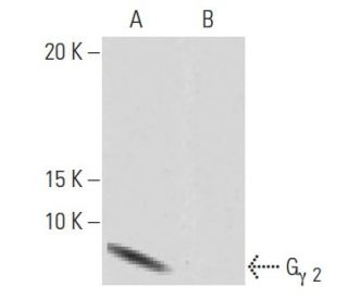 G<sub>&gamma;</sub><sub> 2</sub> Antibody (7-RE20) - Western Blotting - Image 64943