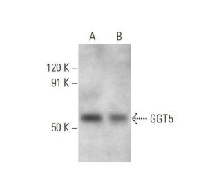 GGT5 Antibody (F-8) - Western Blotting - Image 353427