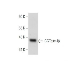 GGTase-I&beta; Antibody (B-11) - Western Blotting - Image 344160 