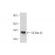 GGTase-Iβ Antibody (B-11) - Western Blotting - Image 344160 
