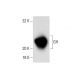 GH Antibody (GH-45) - Western Blotting - Image 137869