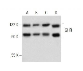 GHR Antibody (B-10) - Western Blotting - Image 59616 