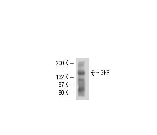 GHR Antibody (MAB 263) - Western Blotting - Image 16355 