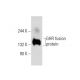 GHR Antibody (MAB 263) - Western Blotting - Image 59984 