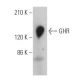 GHR Antibody (MAB 263) - Western Blotting - Image 361828
