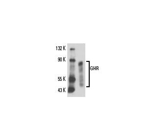 GHR Antibody (MAB 5) - Western Blotting - Image 16382