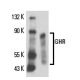 GHR Antibody (MAB 5) - Western Blotting - Image 16382