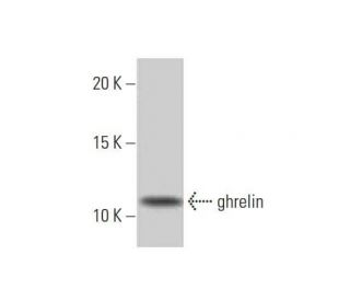 ghrelin Antibody (2F4) - Western Blotting - Image 352193Each CRISPR/Cas9 Knockout (KO) Plasmid product consists of a pool of 3 plasmids designed to ensure identification and cleavage of a specific gene for maximum knockout efficiency. Each plasmid encodes a unique 20 nt sequence derived from the GeCKO (v2) library. 