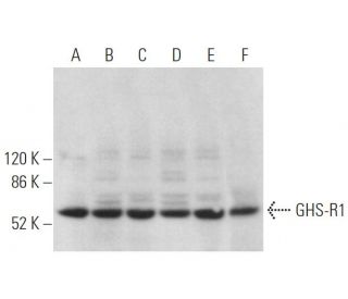 GHS-R1 Antibody (E-7) - Western Blotting - Image 372846 