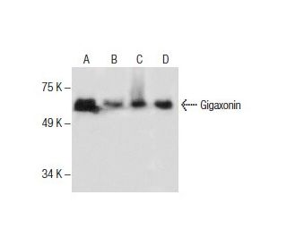 Gigaxonin Antibody (F-11) - Western Blotting - Image 285939 