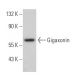 Gigaxonin Antibody (F-11) - Western Blotting - Image 367607