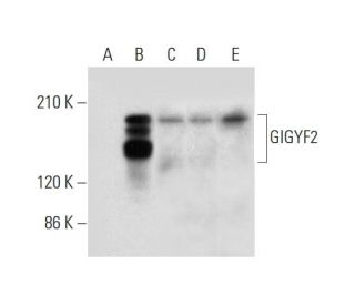 GIGYF2 Antibody (G-5) - Western Blotting - Image 323792 