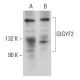 GIGYF2 Antibody (G-5) - Western Blotting - Image 360207