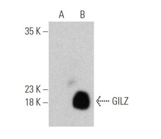 GILZ Antibody (B-2) - Western Blotting - Image 368583 