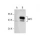 GIPC Antibody (B-6) - Western Blotting - Image 157852