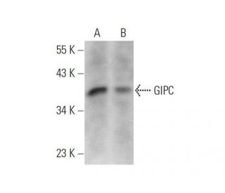 GIPC Antibody (B-6) - Western Blotting - Image 353386 