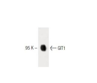 GIT1 Antibody (13) - Western Blotting - Image 60390 
