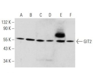 GIT2 Antibody (E-5) - Western Blotting - Image 345895