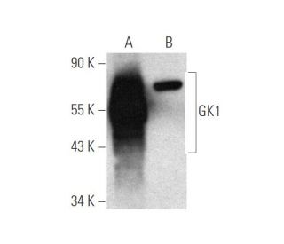 GK1 Antibody (E-4) - Western Blotting - Image 349274 