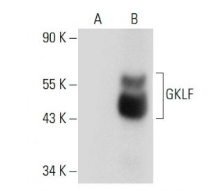 GKLF/KLF4 Antibody (A-2) - Western Blotting - Image 68255