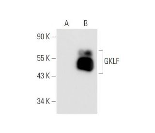 GKLF/KLF4 Antibody (B-6) - Western Blotting - Image 68589