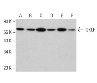 GKLF/KLF4 Antibody (B-8) - Western Blotting - Image 380594 