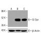 Gl Syn抗体(E-3):sc-515027。通过蛋白质印迹分析未处理(A)和化学处理(B、C)的K-562细胞裂解物中Gl Syn的表达。β-肌动蛋白(C4):sc-47778用作加载对照。使用的检测试剂:m-IgG Fc BP-HRP:sc-525409。 Gl Syn Antibody (E-3) - Western Blotting - Image 415855