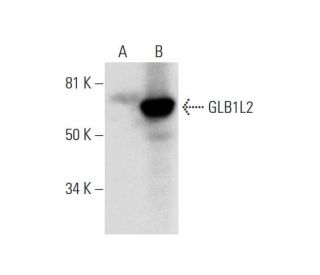 GLB1L2 Antibody (B-10) - Western Blotting - Image 293013 