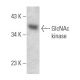 GlcNAc kinase Antibody (G-5) - Western Blotting - Image 354271