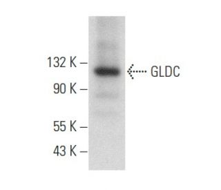 GLDC Antibody (H-9) - Western Blotting - Image 358081
