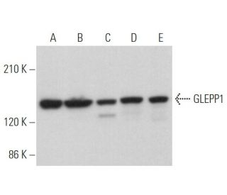 GLEPP1 Antibody (B-6) - Western Blotting - Image 372765 