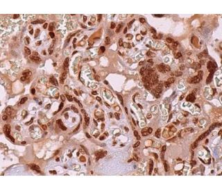 GLI-3 Antibody (B-4) - Immunohistochemistry - Image 368922 