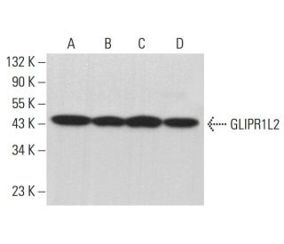GLIPR1L2 Antibody (B-12) - Western Blotting - Image 376383 