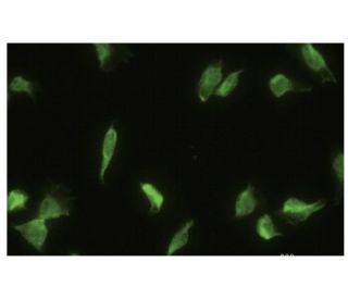 Glomulin Antibody (YY-Z) - Immunofluorescence - Image 35664