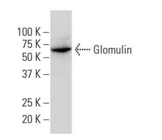 Glomulin Antibody (YY-Z) - Western Blotting - Image 34126 