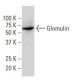 Glomulin Antibody (YY-Z) - Western Blotting - Image 34126 