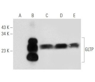 GLTP Antibody (D-9) - Western Blotting - Image 319976 
