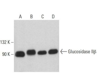 Glucosidase II&beta; Antibody (A-7) - Western Blotting - Image 360223 