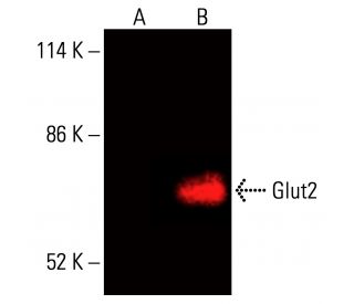 Glucose Transporter Glut2 Antibody (C-10) - Western Blotting - Image 416200 