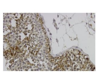 Glycogenin-1 Antibody (4H8) - Immunohistochemistry - Image 36062 
