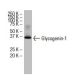 Glycogenin-1 Antibody (4H8) - Western Blotting - Image 33910 