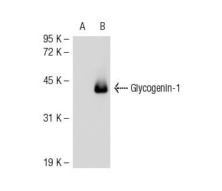 Glycogenin-1 Antibody (4H8) - Western Blotting - Image 51791